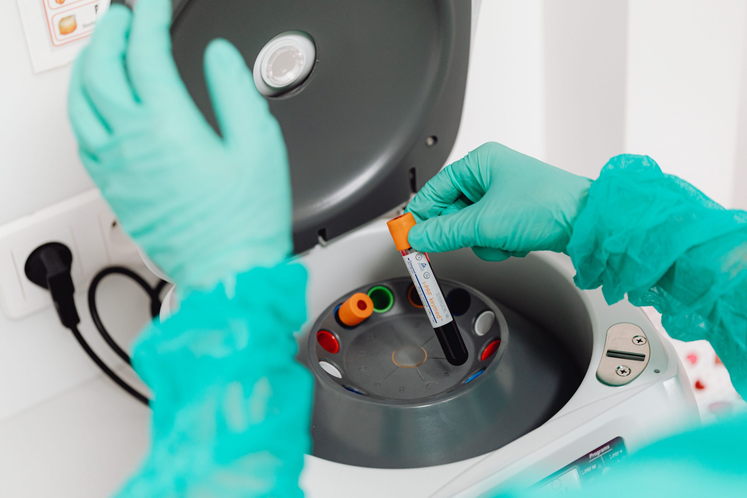 prp platelet rich plasma estelux p-shot istanbul