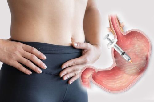 gastric botox in turkey uk patients estelux istanbul