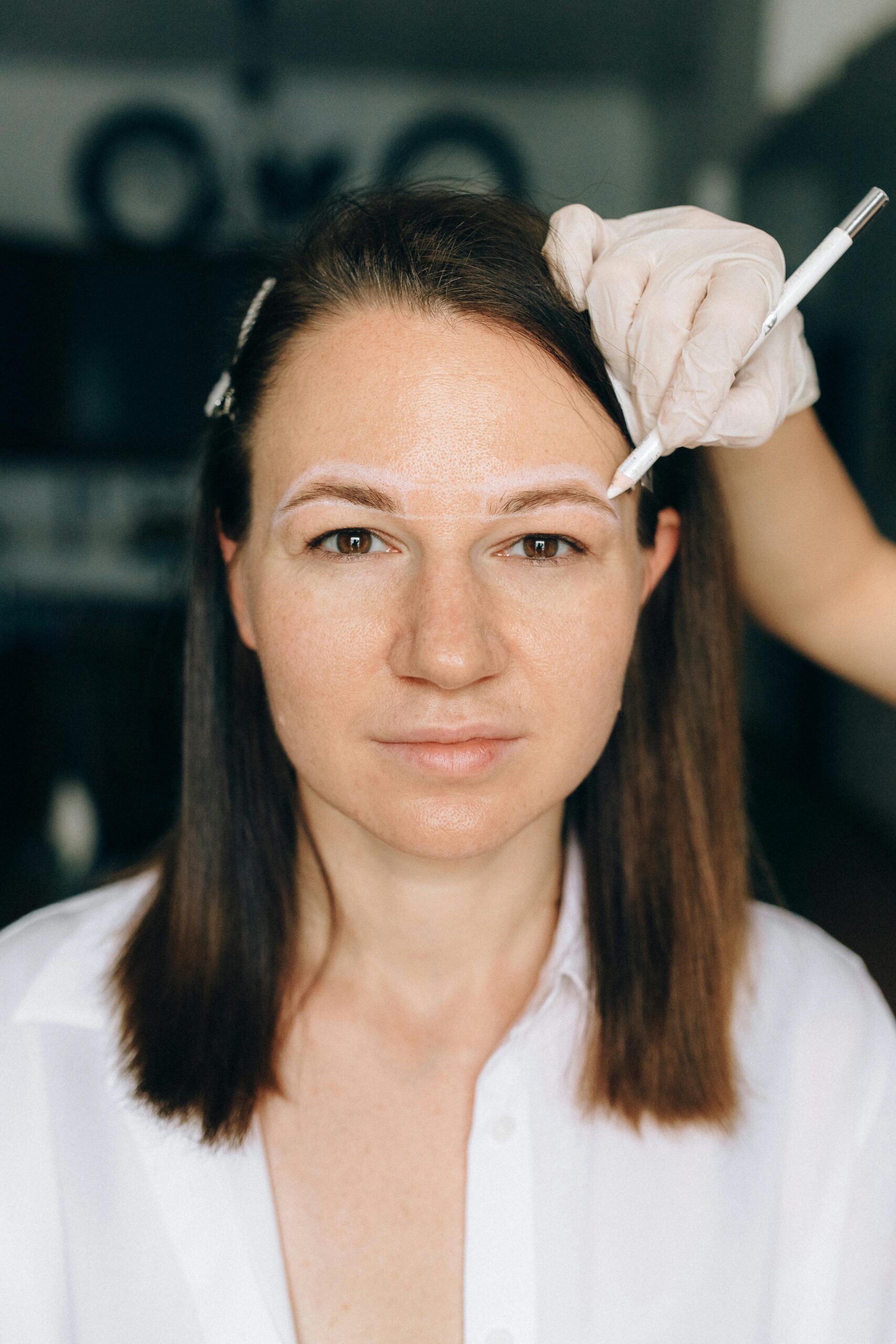 luna method eyebrow transplant istanbul uk patient before after estelux clinic