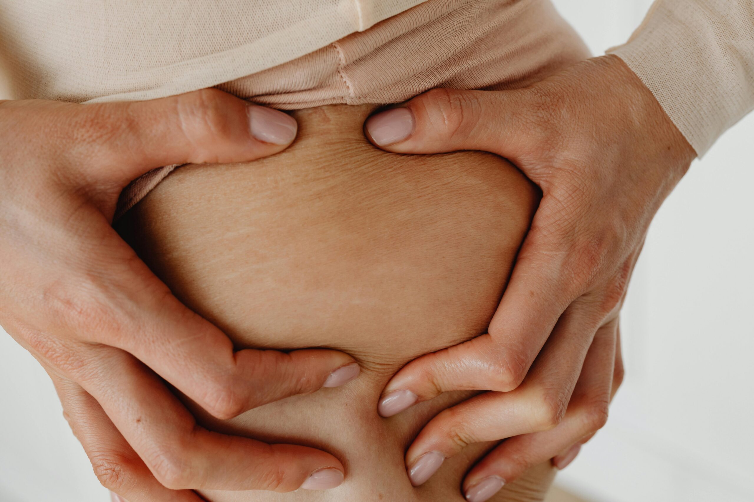 lipoedema vs normal fat difference diagram estelux istanbul