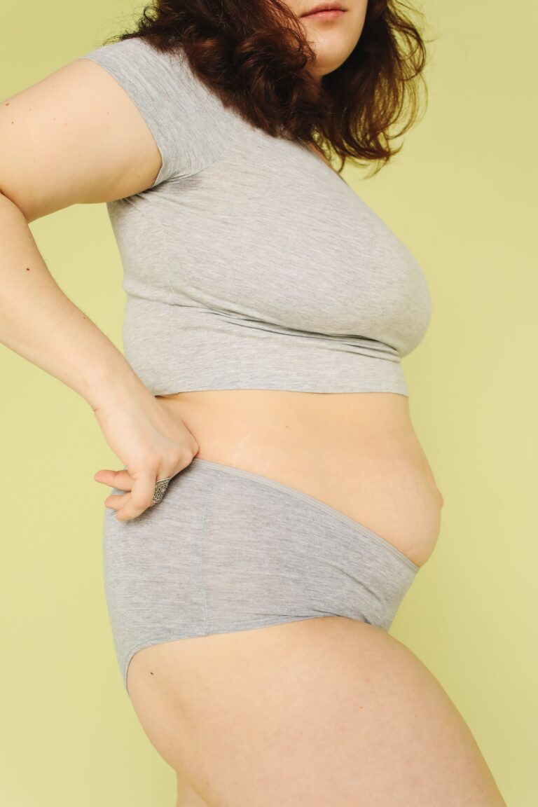 reverse tummy tuck istanbul upper abdomen breast fold scar estelux clinic op dr ugurlu