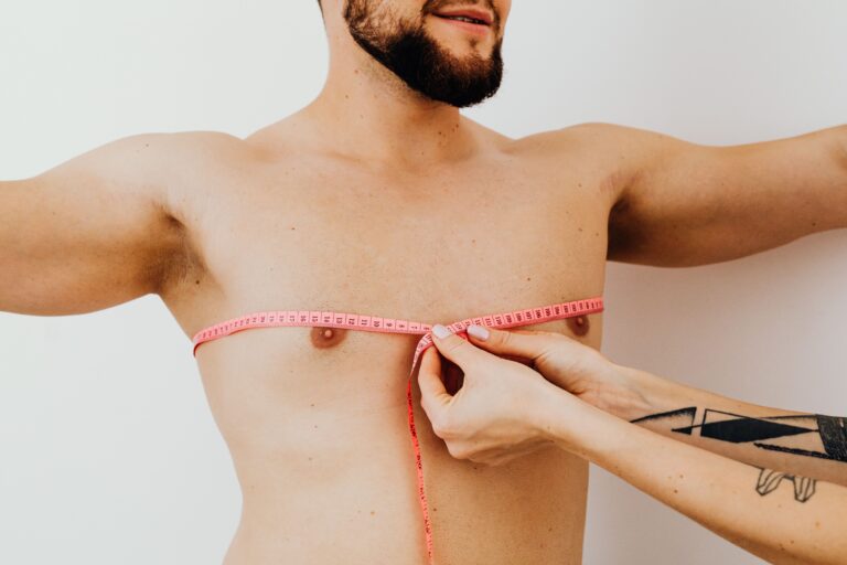gynecomastia istanbul before after male chest reduction estelux op dr ugurlu